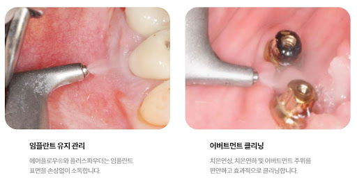 불당본점 서울비디치과의원의 고객 만족도와 평판